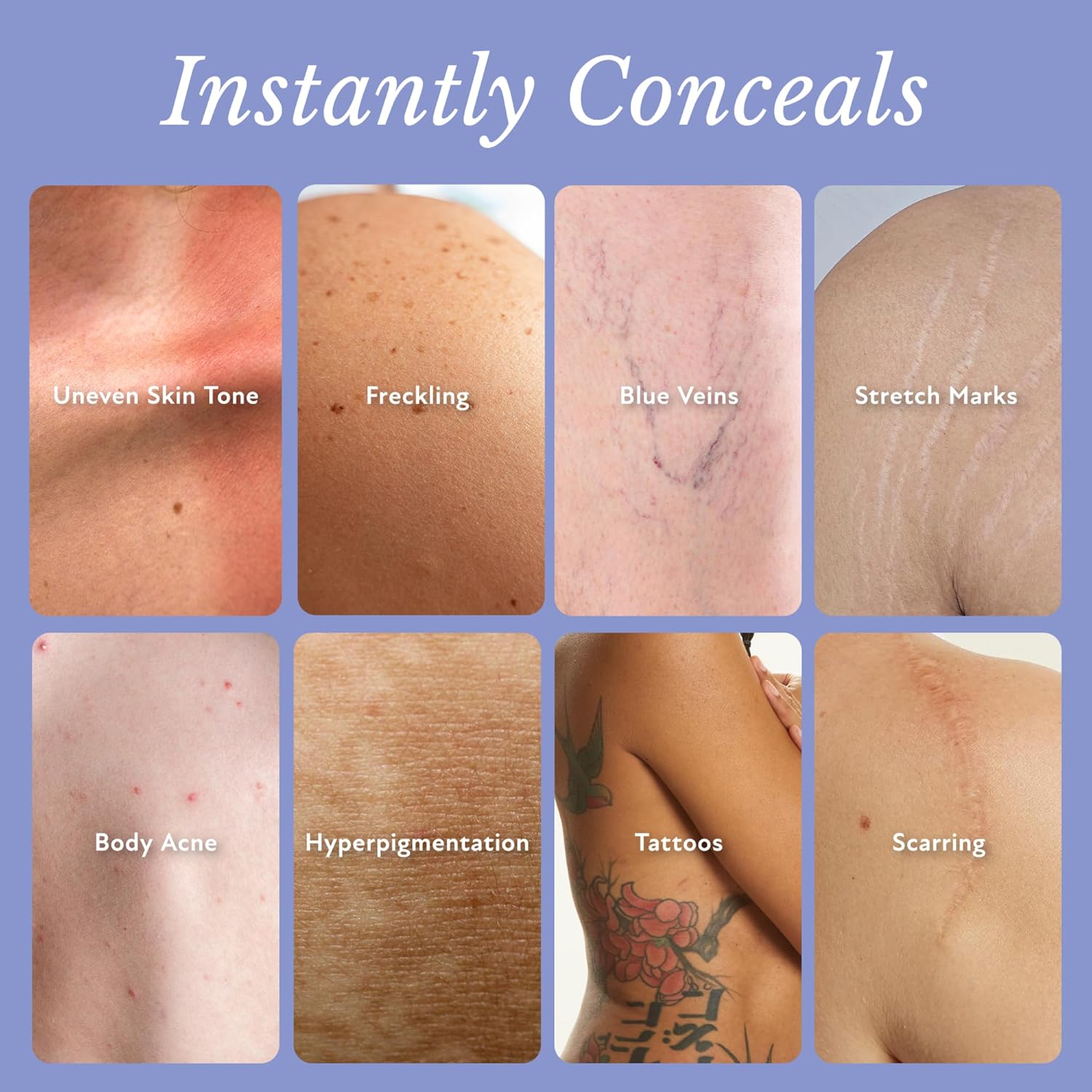 Skingle™ Body Coverage Protector